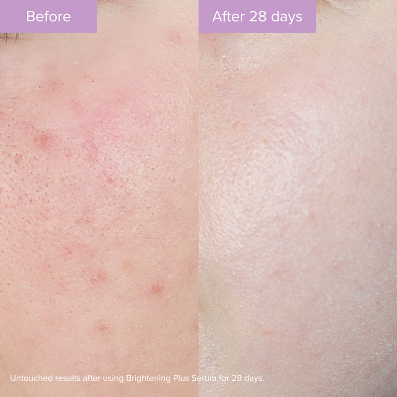 Brightening Plus Serum