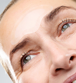 Forehead Microneedling Patch